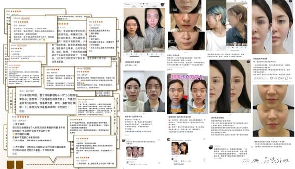 2024轻医美趋势解读:抗衰紧致需要高半岛超声炮最受资深用户喜爱(图5)