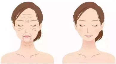 面部微创提升是什么？拉皮手术医生医院维持多久疼不疼