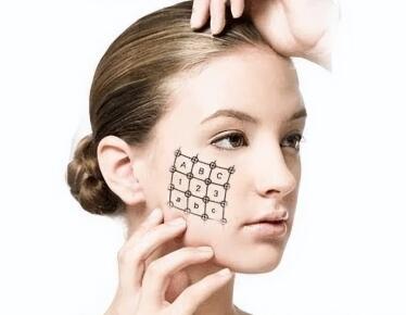 胶原蛋白补充一定要做热玛吉!(图4)