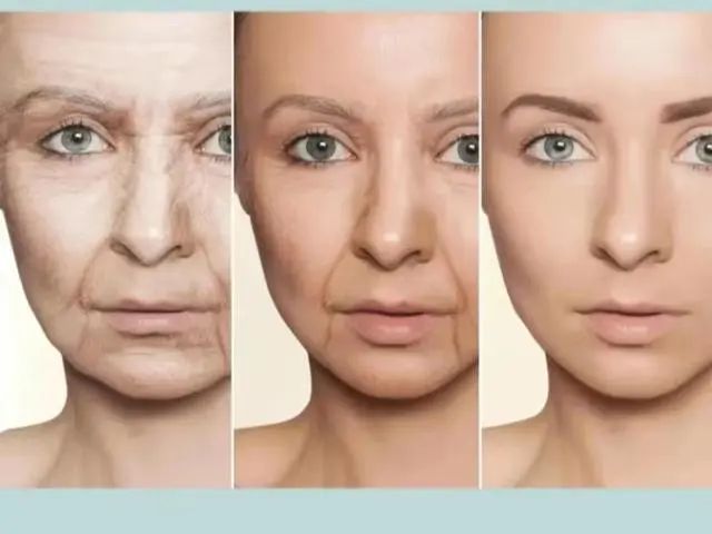 面部提升手术之前有哪些检查？费用医生医院北京预约咨询(图2)