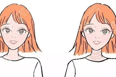 拉皮手术的麻醉方式有哪些？有几种需要全麻吗医生医院咨询