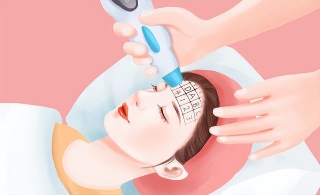 九游娱乐文化：40+想要“显年轻”收藏这份面部抗衰项目合集你会用得到！(图3)