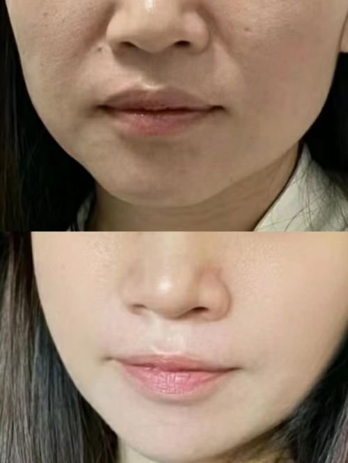 九游娱乐文化：总结：十大最有效抗衰老护肤品总有一款你会喜欢！(图4)