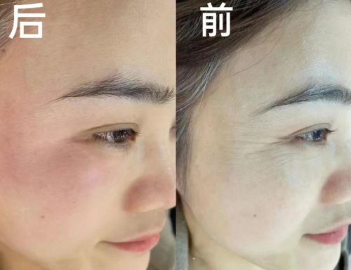 抗皱纹的护肤品有哪些？2024高性价比产品分享(图4)