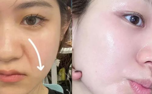 抗皱补水护肤品！2024精品盘点：抗衰老产品这三款是优中选优(图4)