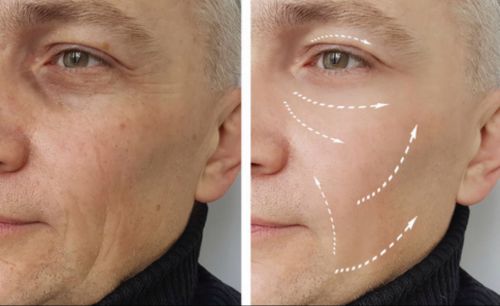 十大最有效抗衰老护肤品这款紧致效果超好(图5)