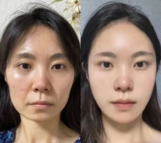 十大最有效抗衰老护肤品淡纹紧致肌肤这款我们的最爱(图4)