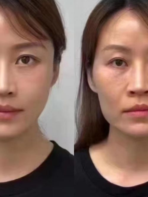 抗皱用什么产品好？2024最值得回购的抗衰老护肤品(图4)