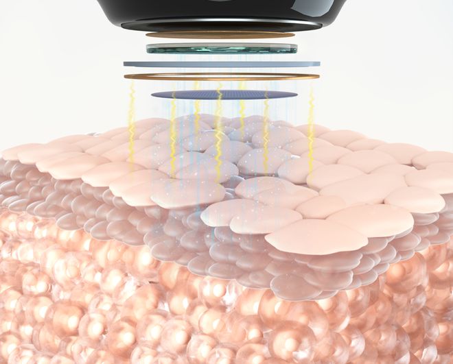 北京载愈纳米电穿孔美容仪、电转仪亮相医疗器械产业精准可控纳米电穿孔递送产品引领行业创新发展(图4)
