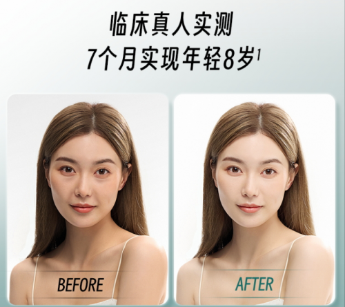 权威背书!AKG之父携手TIMESHOP打造新一代抗衰黑科技:益活新AKGpro(图2)