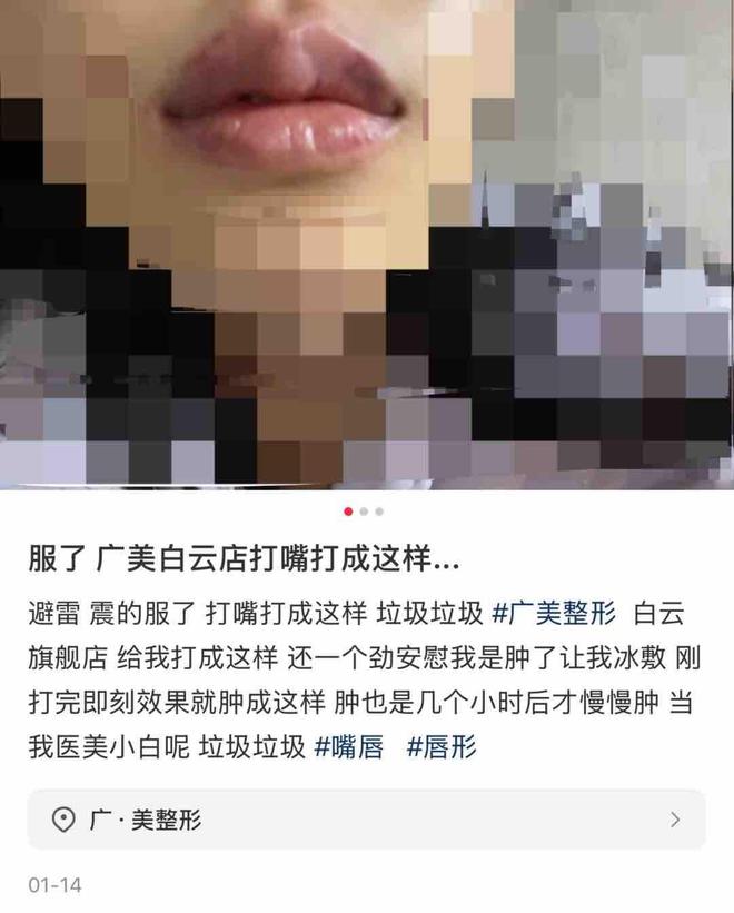 九游娱乐文化：广州广美医疗美容被曝效果差连锁品牌如何突破生存困境？(图10)