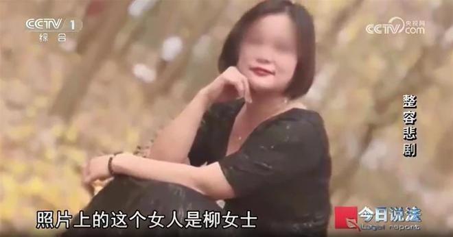 九游娱乐文化:女子瞒着老公贷款2天做6项整容手术身亡有人非法