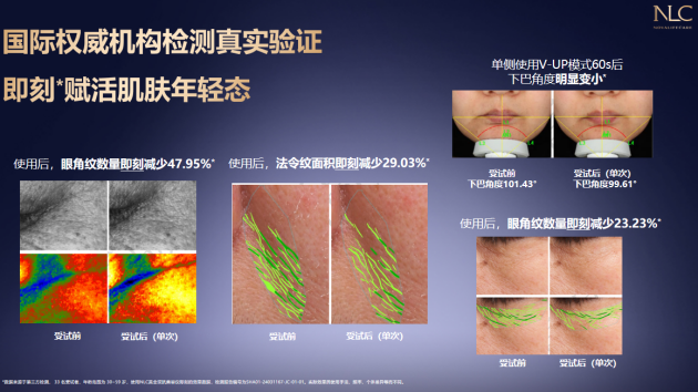 NLC黄金双抗美容仪开启根源抗老新时代(图2)