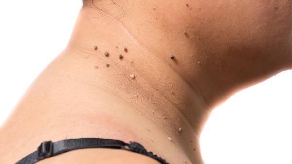 九游娱乐：皮肤抗衰老最好的方法(图2)