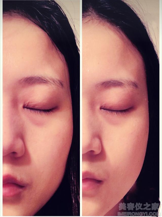 5款最火最值得入手的美容仪还你不老童颜