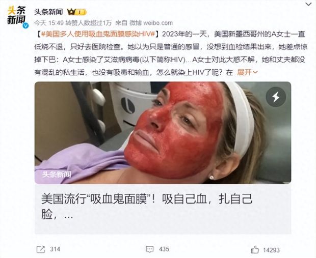 2万一针贵过抗癌药！”童颜针”凭啥迎来百亿级爆发(图4)