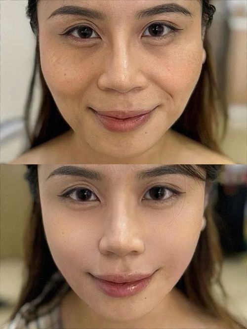 紧致抗衰老的护肤品排行榜！抗衰公布：平价品牌大推荐！(图5)