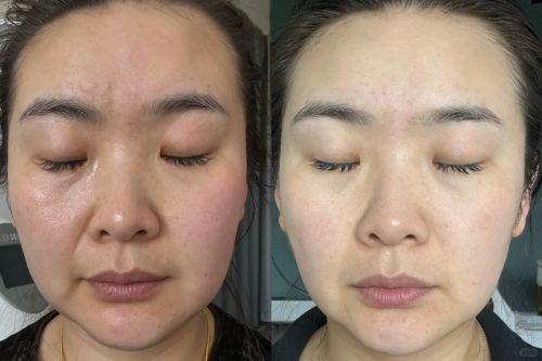 抗老抗衰护肤品排行榜！国货前三：这些平价抗衰品牌值得拥有(图5)