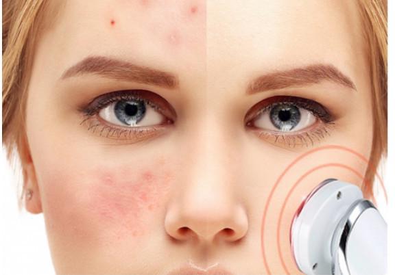 新一轮洗牌在即！家用美容仪将从2024年4月1日起纳入医疗器