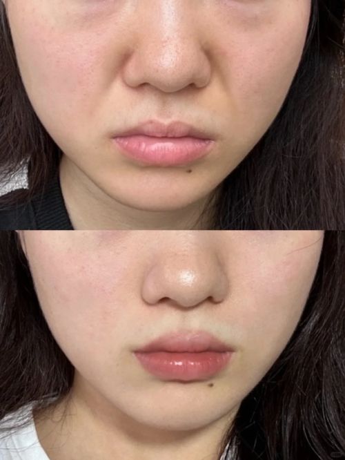 十大最有效抗衰老护肤品!抗老去皱纹护肤品推荐:国内(图5)