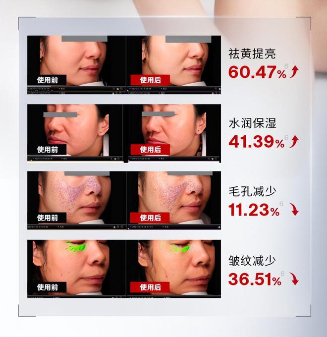 央视独家专访：Jmoon极萌水光美容仪科技抗衰的家居新选择(图5)