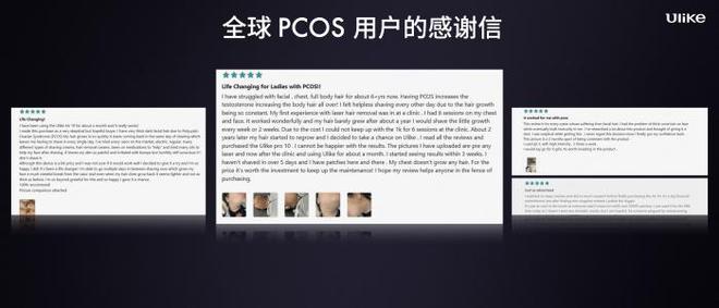 九游娱乐:搭载SHR超级脱毛20技术新一代UlikePro10(图10)