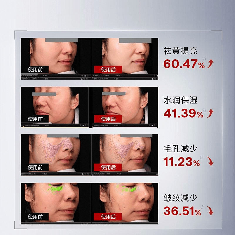 九游娱乐:2025年美容仪品牌十大与热门产品推荐(图5)