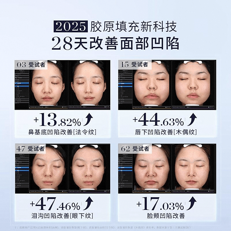 九游娱乐:2025年美容仪品牌十大与热门产品推荐(图11)