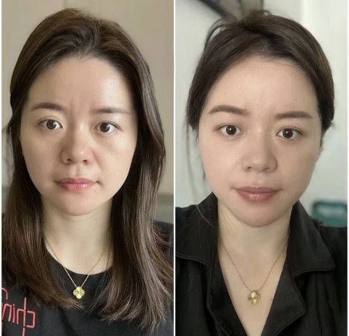 抗皱纹抗衰老的护肤品2024抗老赛道第一名选手(图4)