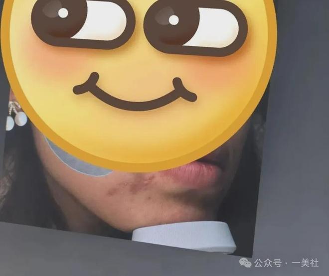 消费者投诉167万元手术后脸部畸形南医大友谊整形身陷信任危机(图5)