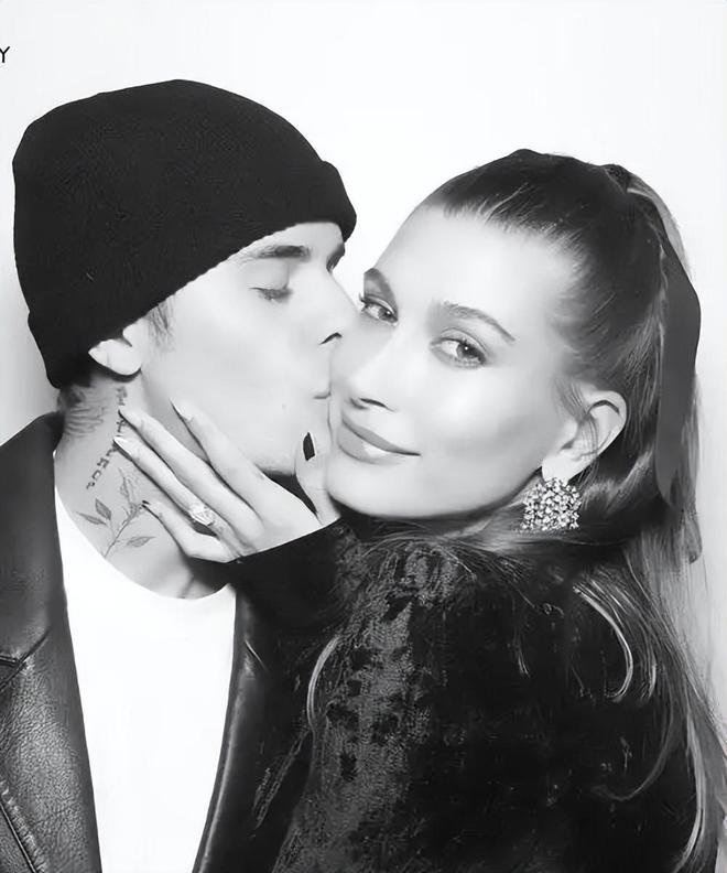 九游娱乐文化：HaileyBieber亲口承认医美经历！这一波坦白太炸了！(图4)